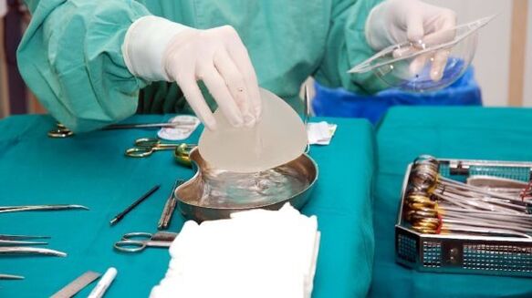 implantat za povećanje grudi